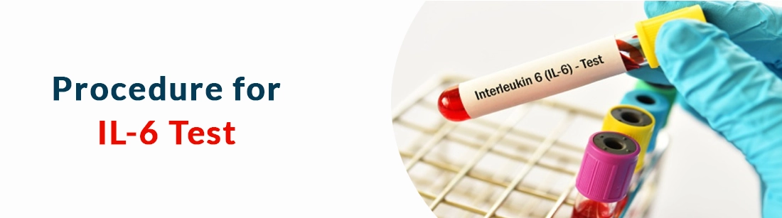 Procedure for IL-6 Test